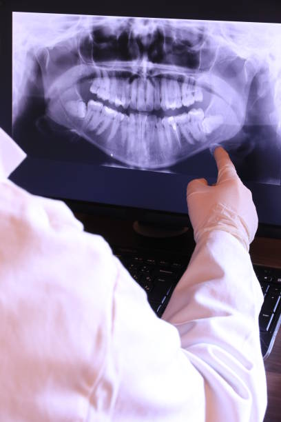Best Emergency Treatment for Dental Infections or Abscesses in Placerville, CA