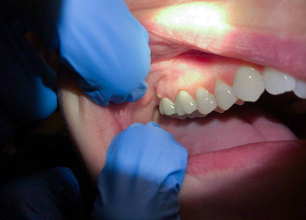 Best Cosmetic Emergency Dentistry in Placerville, CA